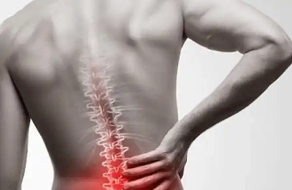علائم فتق دیسک کمر + علت و درمان و راههای پیشگیری از آن