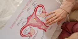علائم سندرم آشرمن + علت و درمان و راههای پیشگیری از آن