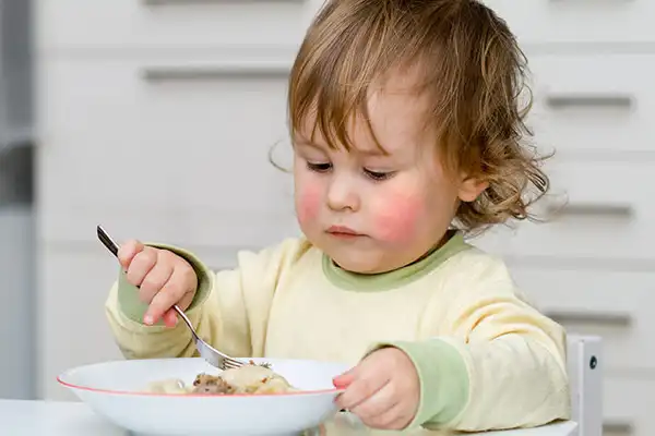 عوارض آلرژی غذایی + تشخیص و راههای پیشگیری و درمان آن