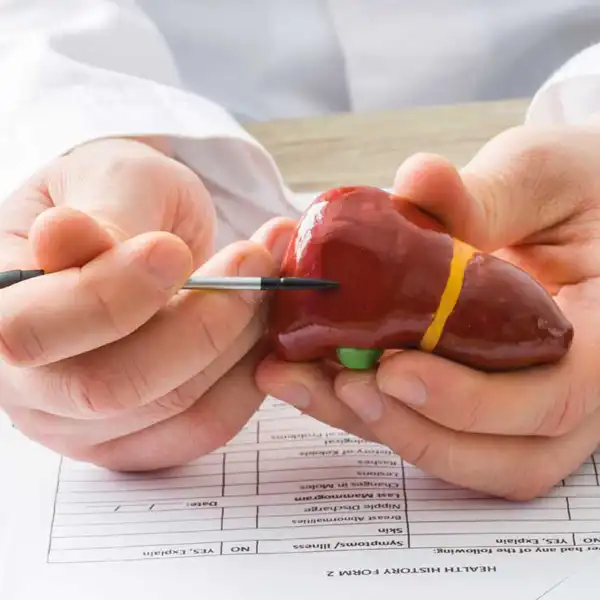 عوارض درد کیسه صفرا + تشخیص و راههای پیشگیری و درمان آن