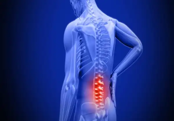 عوارض التهاب دیسک کمر + تشخیص و راههای پیشگیری و درمان آن