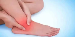 عوارض گرفتگی رگ پا + تشخیص و راههای پیشگیری و درمان آن