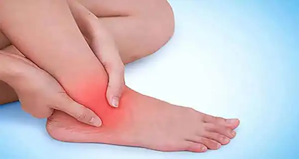 عوارض گرفتگی رگ پا + تشخیص و راههای پیشگیری و درمان آن