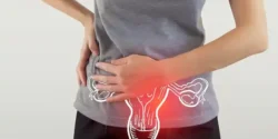 عوارض پیچ‌خوردگی تخمدان + تشخیص و راههای پیشگیری و درمان آن