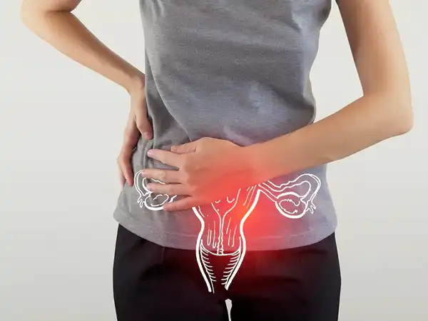 عوارض پیچخوردگی تخمدان + تشخیص و راههای پیشگیری و درمان آن