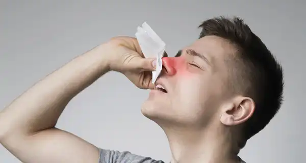 عوارض پولیپ بینی + تشخیص و راههای پیشگیری و درمان آن