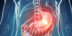 عوارض زخم اثنی عشر + تشخیص و راههای پیشگیری و درمان آن