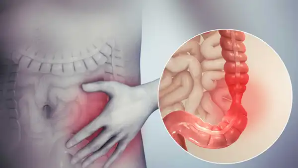 عوارض آبسه کبدی + تشخیص و راههای پیشگیری و درمان آن