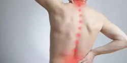 عوارض دیسک کمر + تشخیص و راههای پیشگیری و درمان آن