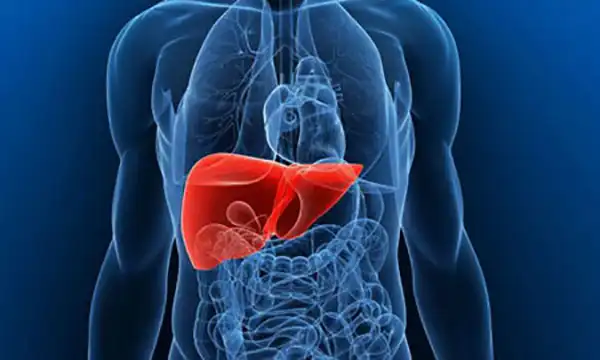 عوارض کبد چرب غیر الکلی + تشخیص و راههای پیشگیری و درمان آن