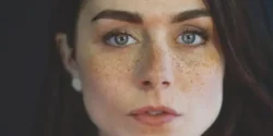 عوارض لک صورت + تشخیص و راههای پیشگیری و درمان آن