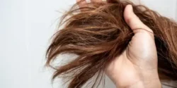عوارض موخوره + تشخیص و راههای پیشگیری و درمان آن