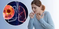 عوارض عفونت ریه + تشخیص و راههای پیشگیری و درمان آن