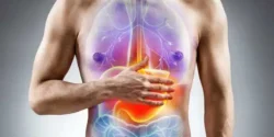 عوارض ثقل معده + تشخیص و راههای پیشگیری و درمان آن