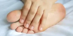 عوارض سوزش کف پا + تشخیص و راههای پیشگیری و درمان آن