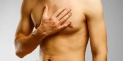 عوارض ژنیکوماستی + تشخیص و راههای پیشگیری و درمان آن